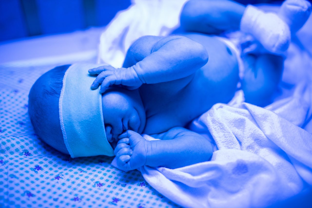 newborn-having-a-treatment-for-jaundice-under-ultr-2021-09-03-10-32-34-utc-1280x854.jpg